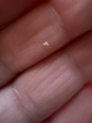 Unable to identify - possibly skin flake or debris