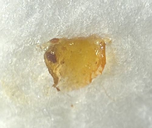 Not a bug/insect (Likely Earwax or Dried Secretion)