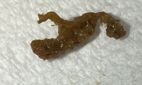 Non-insect material (likely plant matter or debris)