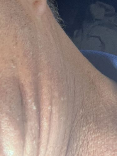 No insect or bug identified