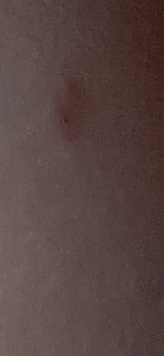 There is no identifiable insect or bug in the provided images.