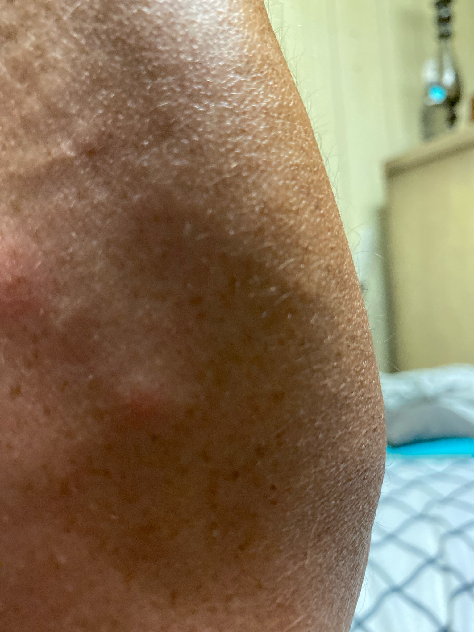 Cannot identify