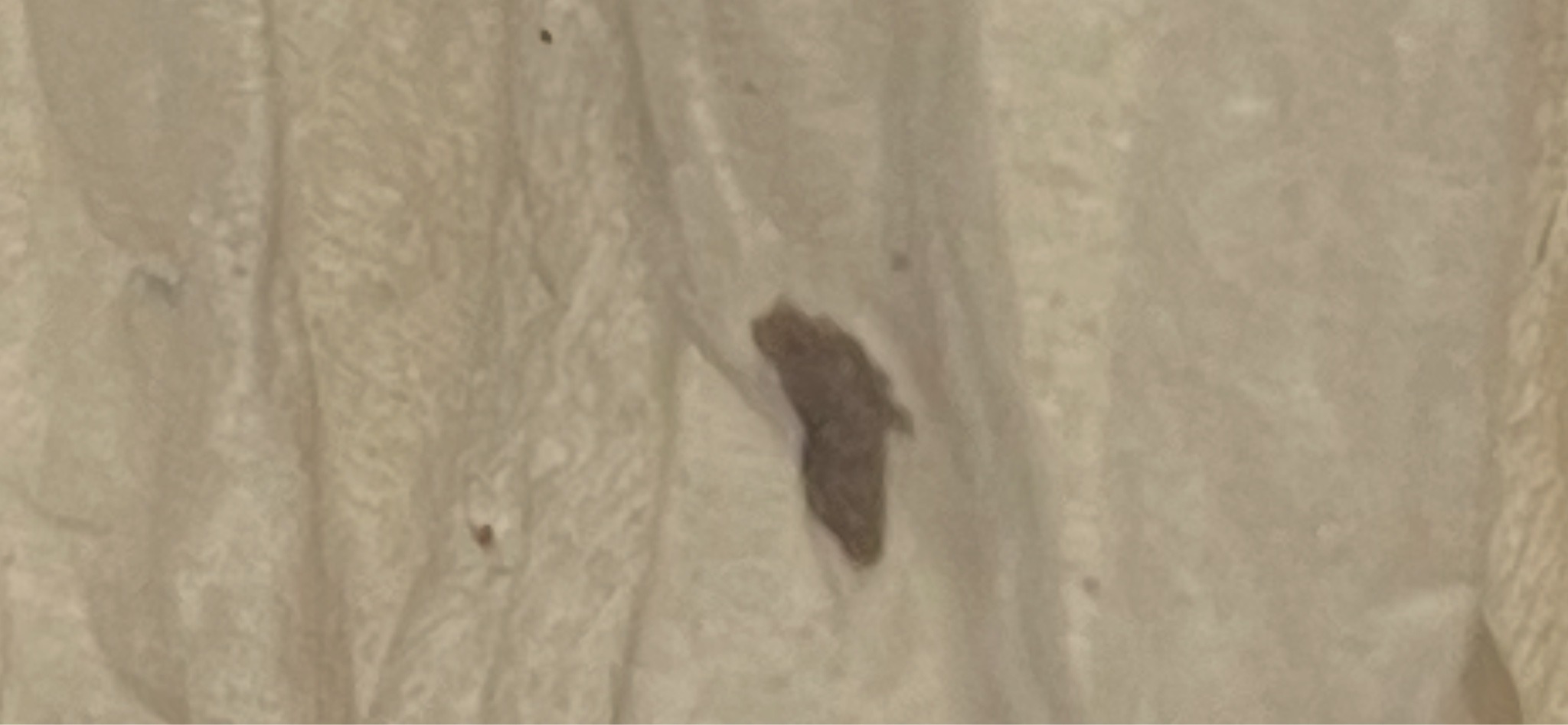 Carpet beetle larva (likely varied carpet beetle)