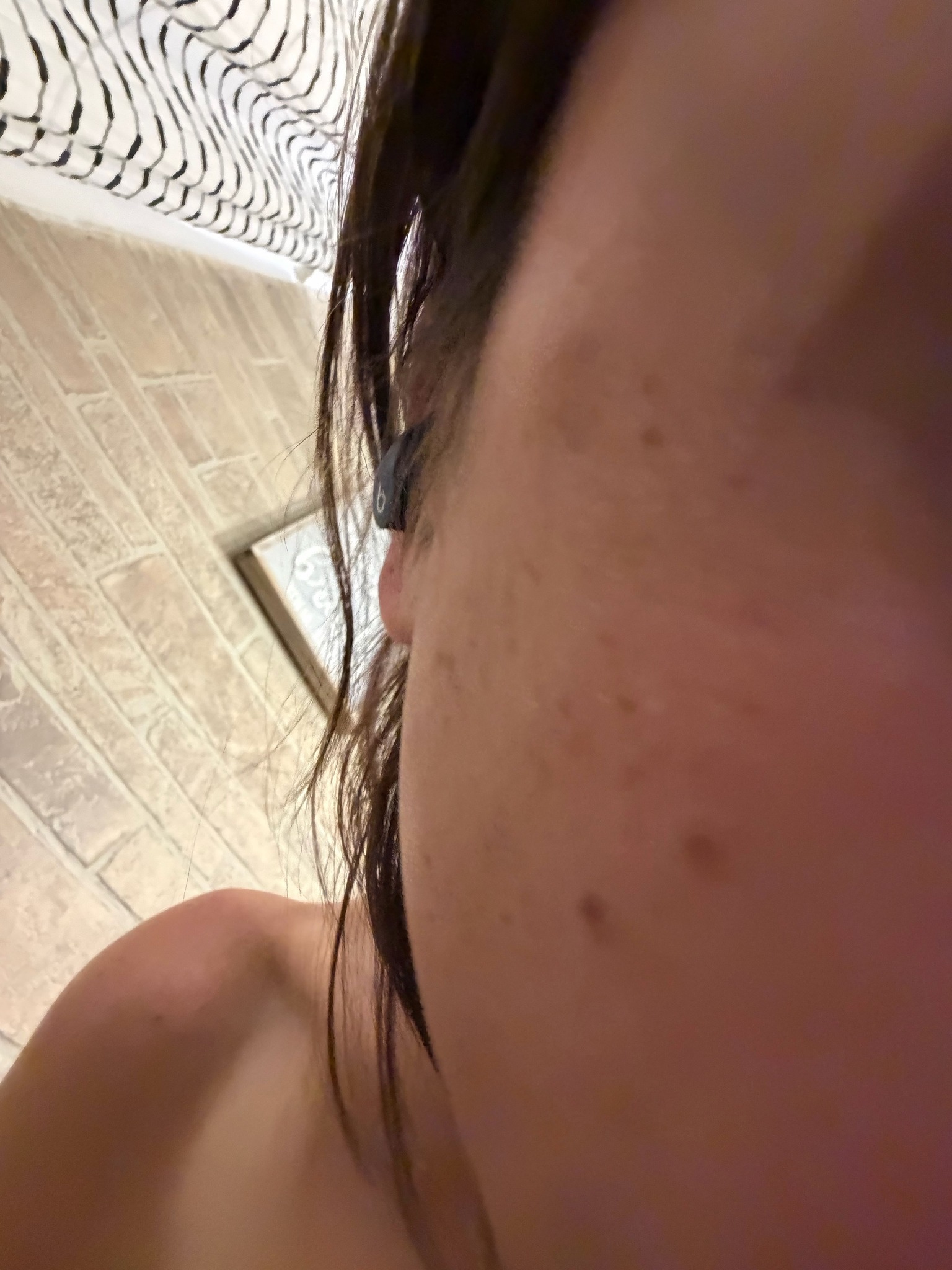 No insect identified