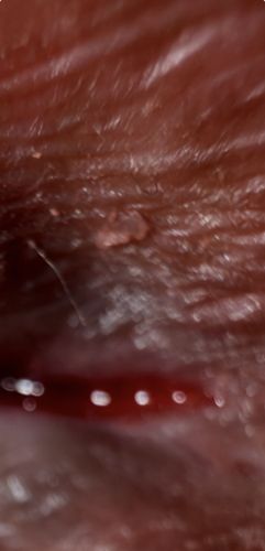 No insect or bug identified