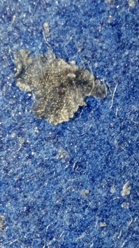 Human Skin Cell / Dead Skin Flake