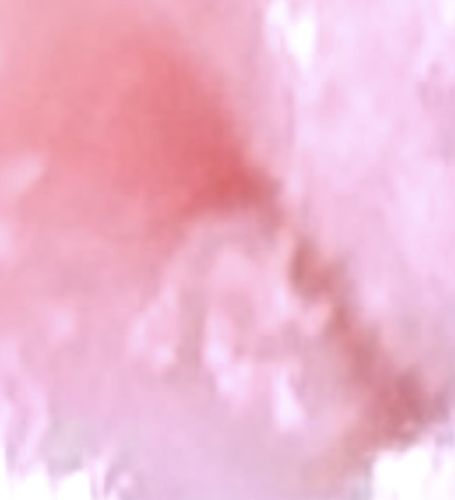 Unidentifiable due to image quality