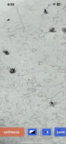 Nematode (specifically, likely a plant-parasitic or free-living soil nematode based on the morphology observed, though exact species cannot be determined from the image resolution)