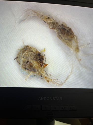 Household Casebearer, Plaster Bagworm