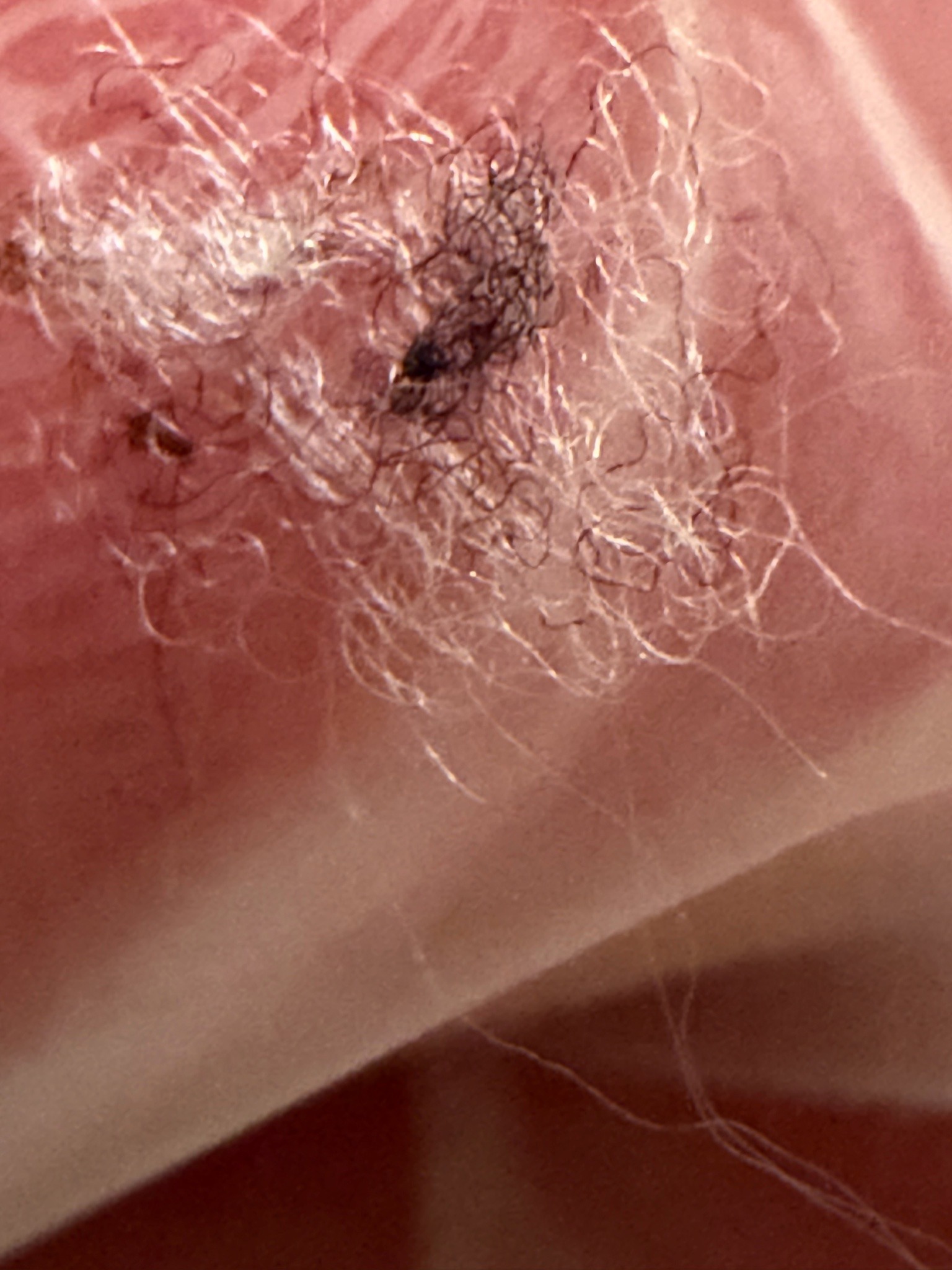 Clothing Lint and Fiber