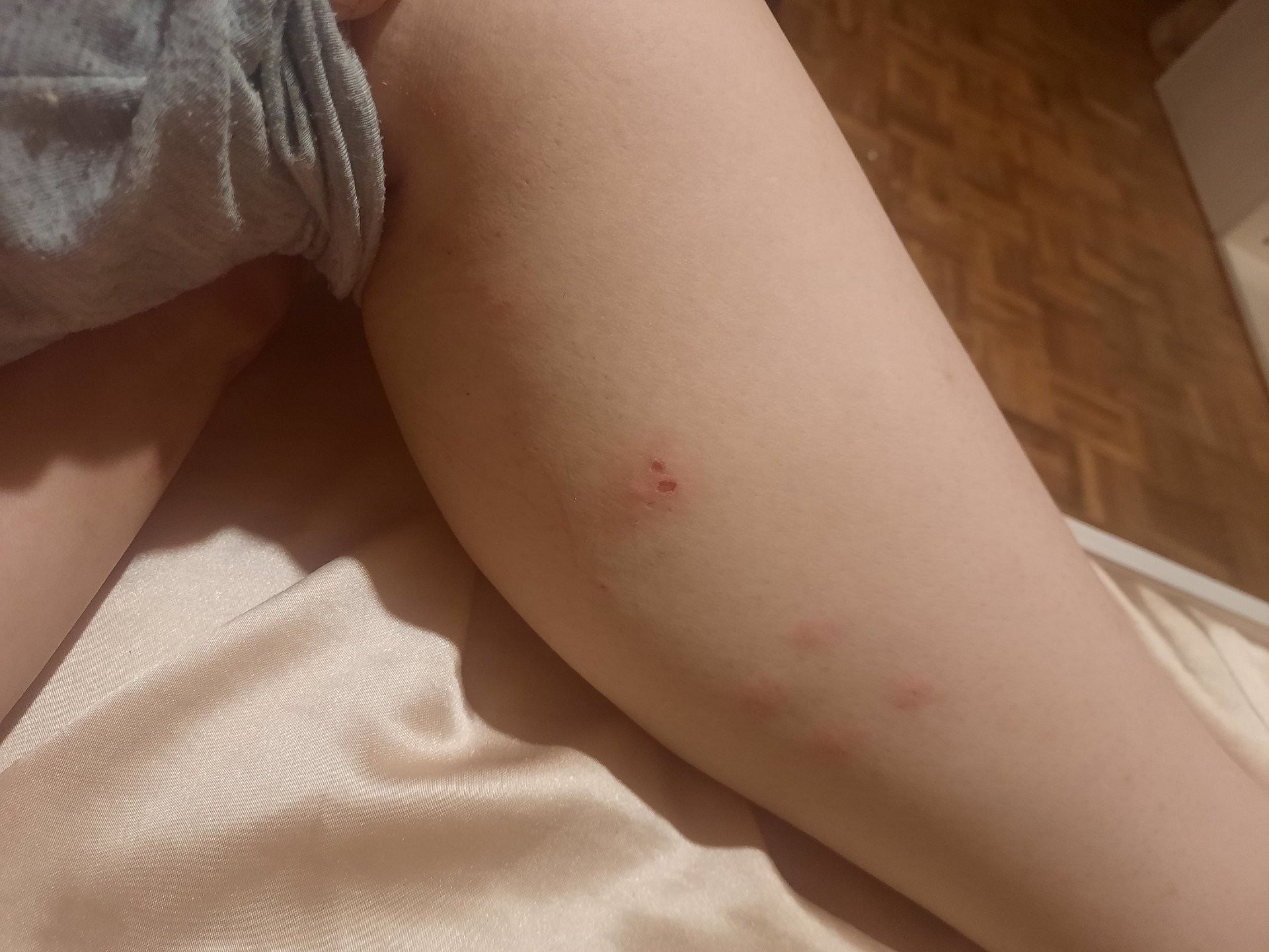 Common Bed Bug