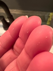 Mites (general, speficially a type of dust mite or similar micro-arthropod)