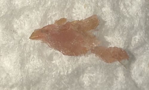 Not a bug (Debris/Skin Flake)