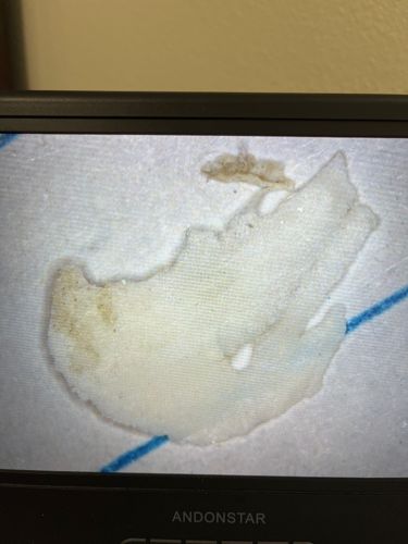 Mold or Fungi (not an insect)