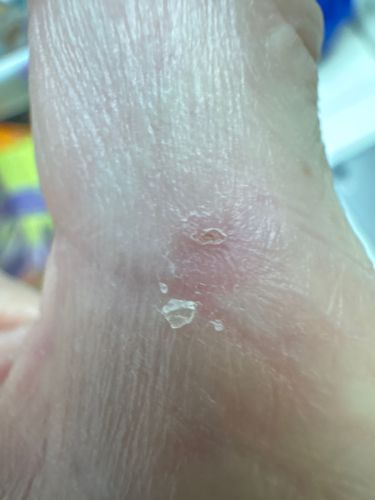 Not identifiable as an insect or bug