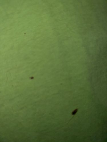 Fly (General, likely a small species such as a fruit fly or fungus gnats)