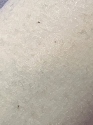 Bird mite or Rodent mite