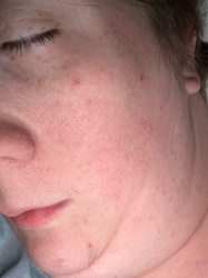 Unidentifiable organism