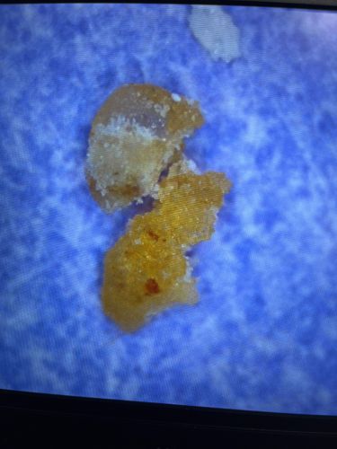 Unidentifiable organic debris