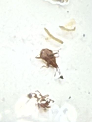Bird Mite (likely Northern Fowl Mite or Chicken Mite)