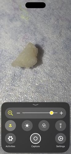 Not an insect (likely rice or food residue)