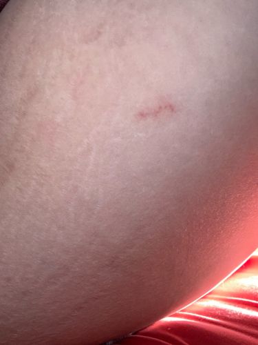 It is not possible to identify an insect or bug from the provided image. The image shows a small, red mark on what appears to be human skin, which could be anything from a scratch, a bite, a rash, or another skin irritation. Without a clear image of an insect, identification is not possible.