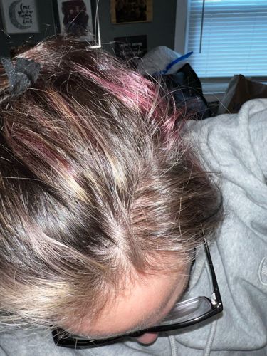 No insect identified