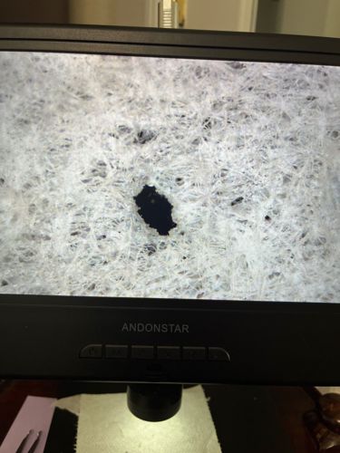 Unidentifiable Specimen (due to insufficient visual information)