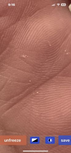 Dust Mite