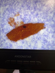 Unidentifiable Organism/Debris