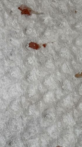 Pubic louse (also known as Crab louse)