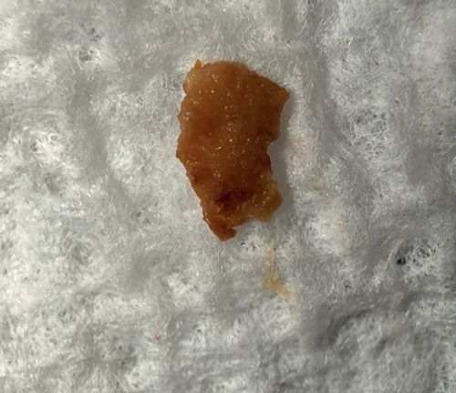 Non-insect matter (Possible skin tag, scab, or food residue)