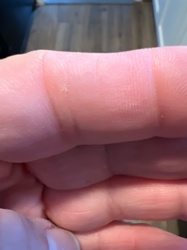 Unidentifiable speck