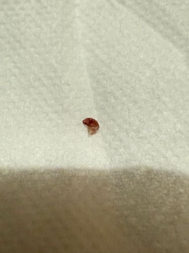 Unidentifiable organic matter