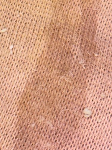 Not identifiable as an insect