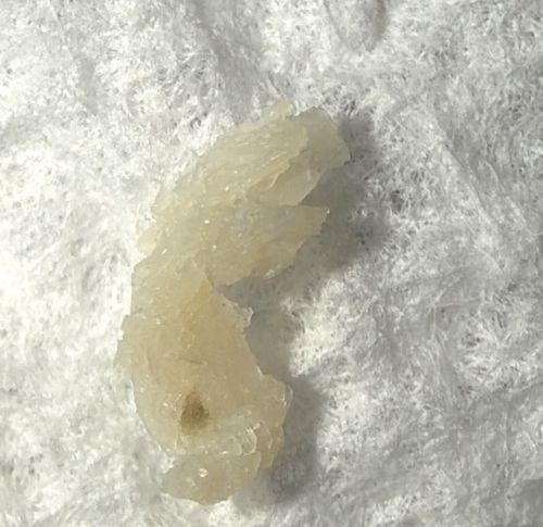 Not a bug (Likely Earwax or Dried Fluid)