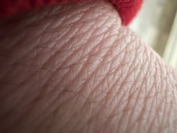 Itch mite