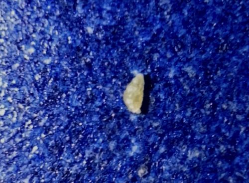 Body Louse (or Head Louse) Nit