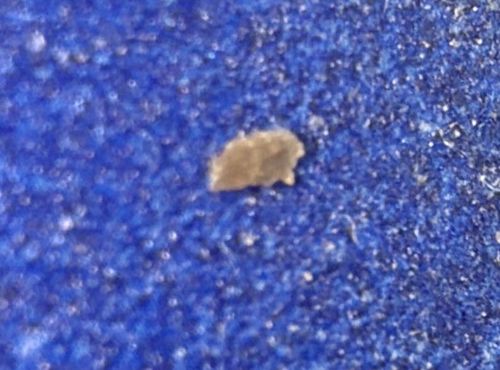 Tapeworm Segment (Proglottid)