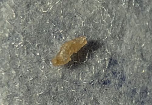 Tapeworm Segment (Proglottid)