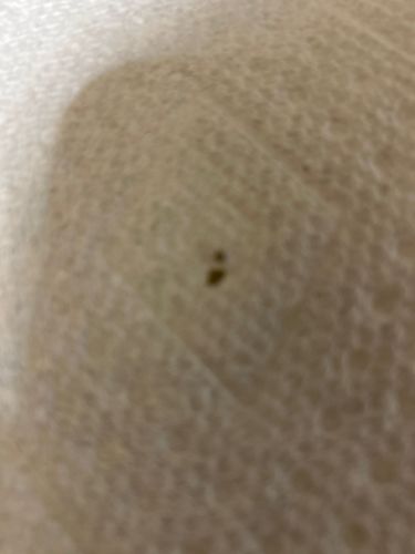 Unidentifiable due to image quality