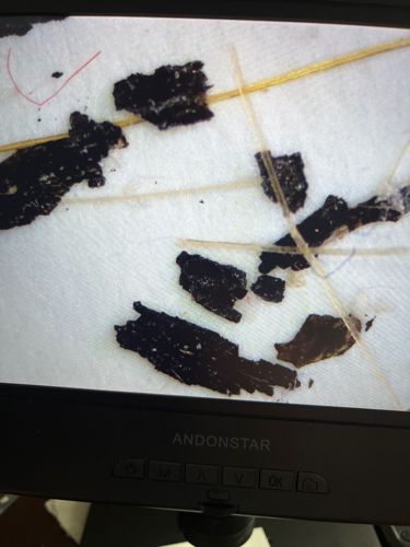 Not identifiable from image