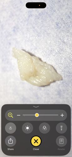 Inconclusive (Likely Non-Biological)