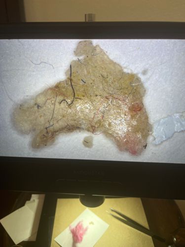 Unidentifiable organic debris