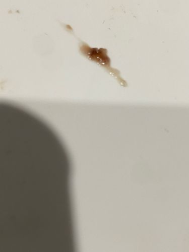 Inconclusive (Likely non-biological residue)