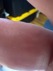 Mites (general, possibly dust mites or oribatid mites)