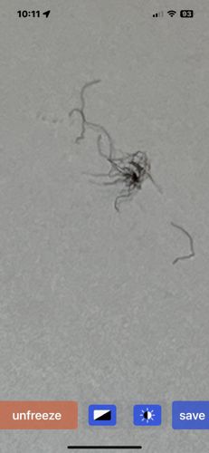 Not identifiable as an insect or bug