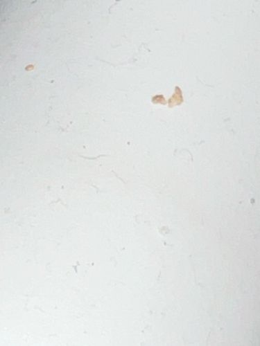 Unidentifiable organic debris