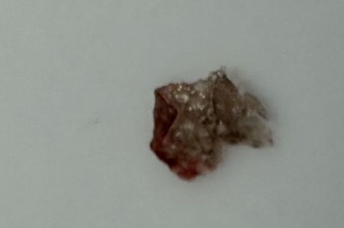 Not a Bug/Insect (Likely Earwax or Mineral Debris)