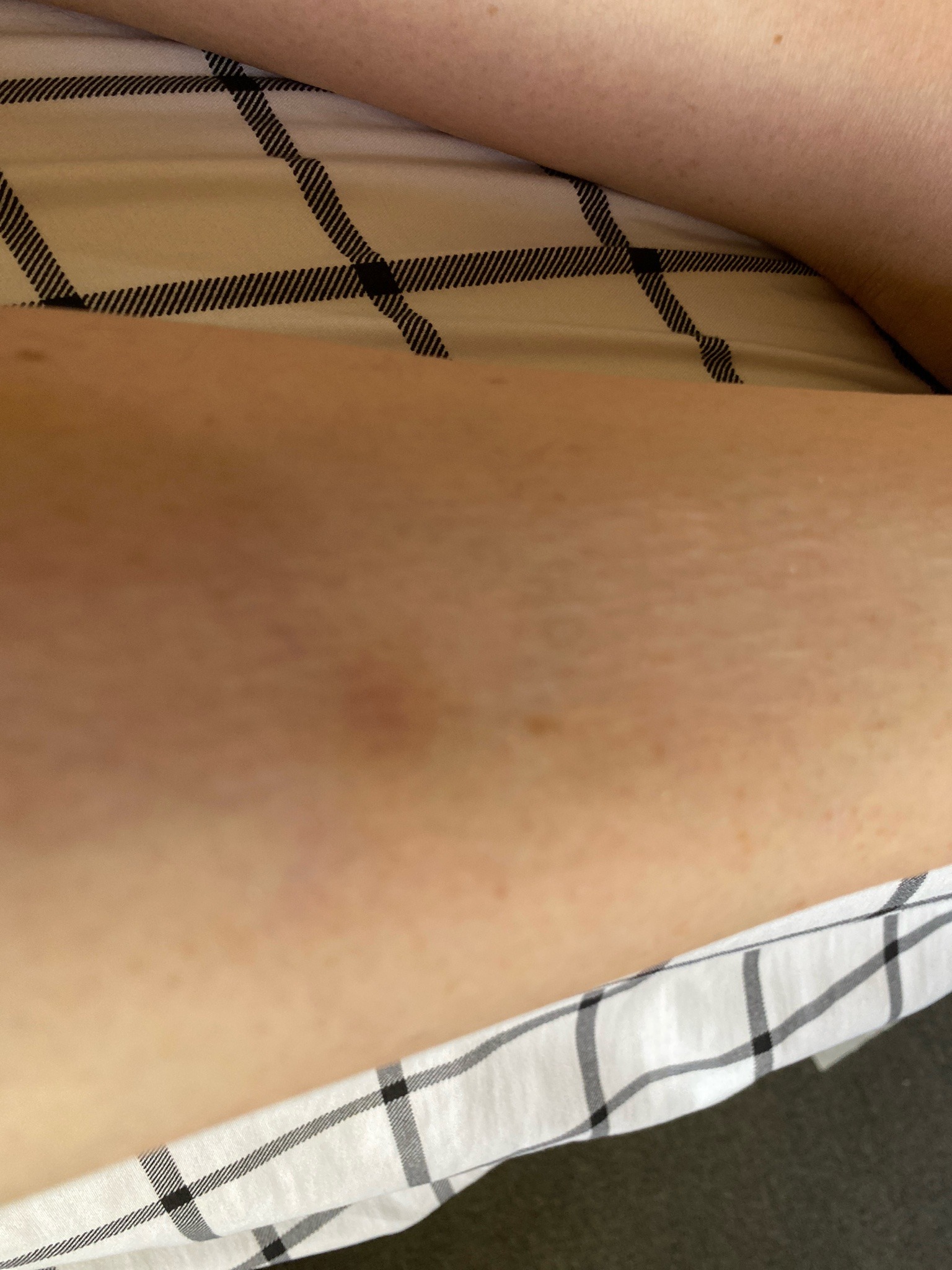 Bed Bug